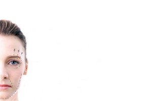 Ultherapy ulthera