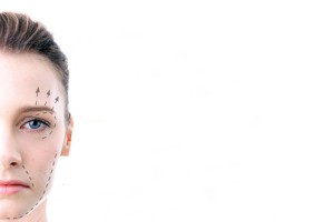 Ultherapy zones