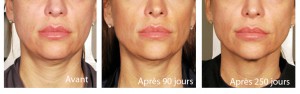 Centre-Ultherapy-Paris