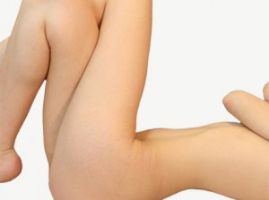 Ultherapy avant apres