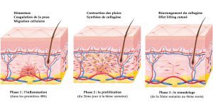 shema ultherapy